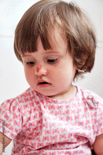 Close up portrait baby girl with a scratch on her nose isolated on the white background. Child safety concept, injuries from falling down