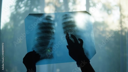 Holding X-ray image of human chest on window background, doctor checking fluorography of patient on light, lungs check-up after coronavirus pandemic. Looking at lungs x-ray with ribs. photo