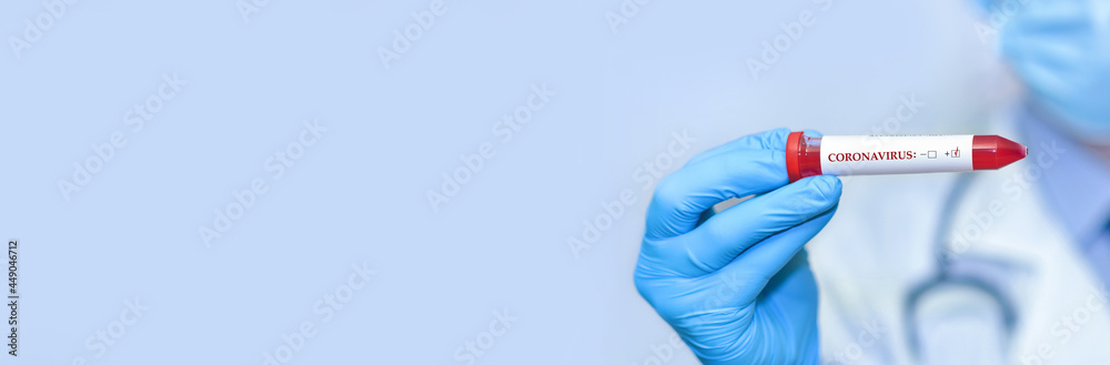 Fototapeta premium Doctor holding a test blood sample tube positive with strain COVID-19.Banner. Copy space for text