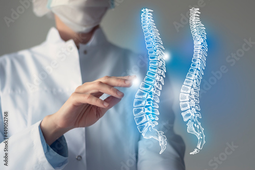 Unrecognizable doctor caring highlighted blue handrawn  Spine. Medical illustration, template, science mockup. photo