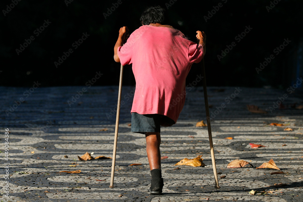 Disabled one-legged handicapped homeless man walking on crutches at ...