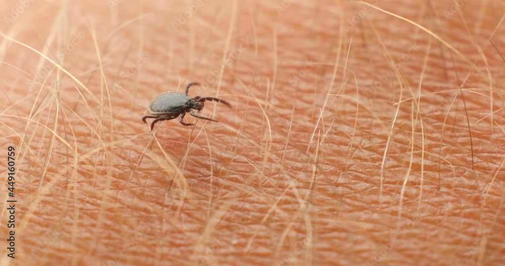 Tick crawling in hairs - 4K macro shot Tick crawling in hairs - 4K macro shot