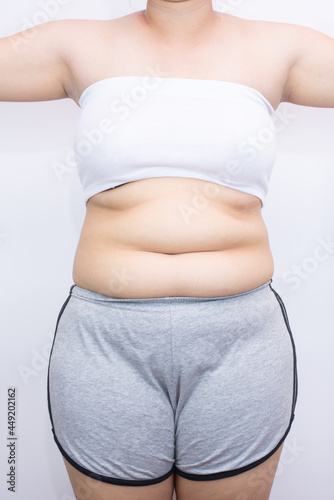 beautiful fat woman standing on white background she wants to lose weight The concept of underarm liposuction surgery lose belly fat and break down thigh fat.