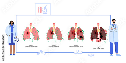 Lungs cancer disease