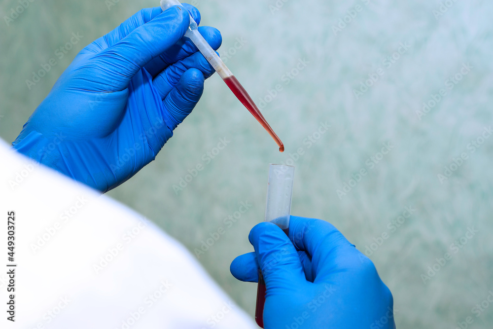 a medical worker in a white coat and blue gloves draws blood from a test tube with a pipette for analysis