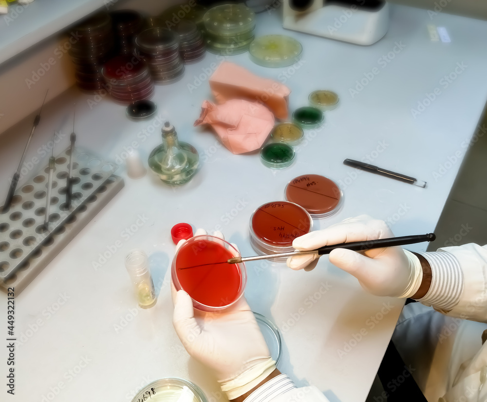 Microbiology, technician working with bacteria strains. stool culture, closeup Microbiology, technician working with bacteria strains. stool culture, closeup