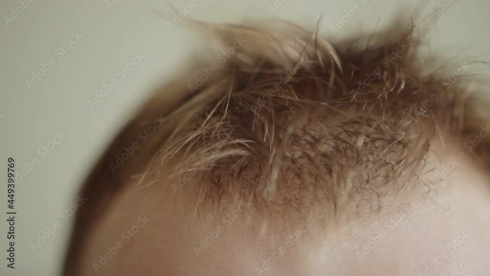The man is wiping sweat from his forehead and wet hair from work and heat. Close-up The man is wiping sweat from his forehead and wet hair from work and heat. Close-up