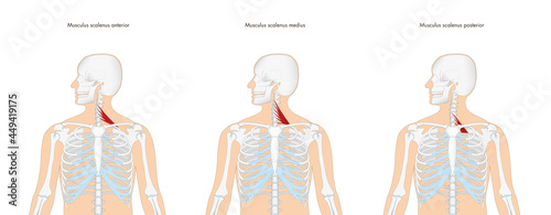 Anatomie - Halsmuskulatur - Musculi scaleni mit lateinischer Beschriftung photo