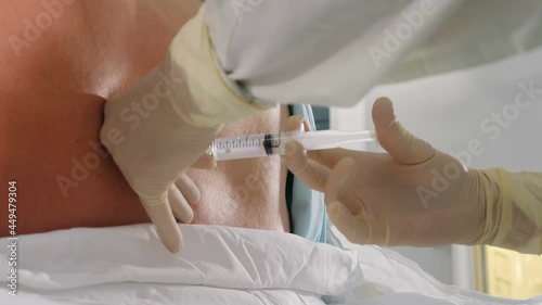 Spinal anesthesia injection, epidural anesthesia or nerve block. Anesthesiologist at work. Anesthesiologist or doctor holding epidural needle near patient back, Preparation for caesarean section or