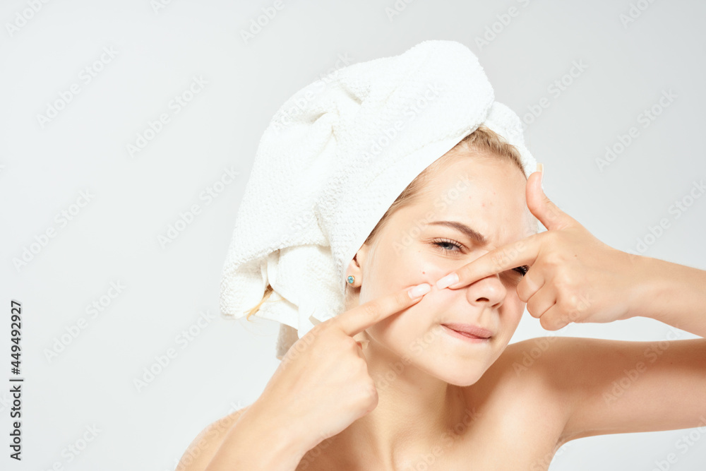 woman with bare shoulders with a towel on her head squeezes out pimples and dermatology hygiene woman with bare shoulders with a towel on her head squeezes out pimples and dermatology hygiene