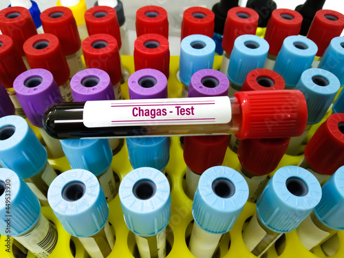 
FILE #:  448305698
 Preview Crop
 Find Similar
Test Tube with blood sample for Chagas test, (American trypanosomiasis). Diagnosis of Chagas disease. A medical testing concept in the laboratory. photo