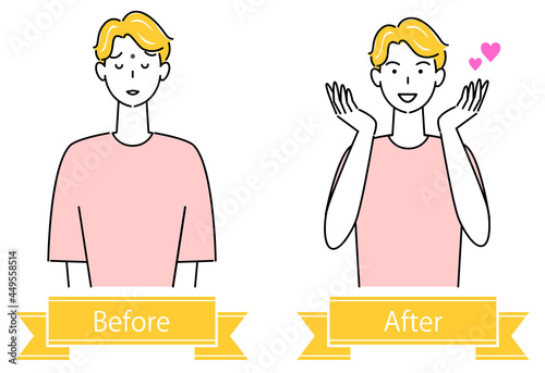 スキンケア 顔のお肌トラブル"ほくろ"のビフォーアフター 可愛い男性のイラスト シンプル ベクター