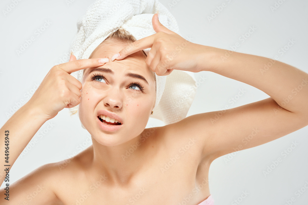 woman with bare shoulders with a towel on her head squeezes out pimples and dermatology hygiene woman with bare shoulders with a towel on her head squeezes out pimples and dermatology hygiene