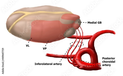 Foto Blood supply of thalamus with inferolateral arteries.