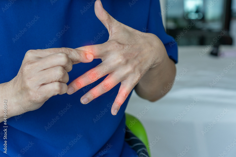 Foto de Overuse hand problems. Woman’s hand with red spot o fingers as suffer from Carpal tunnel
