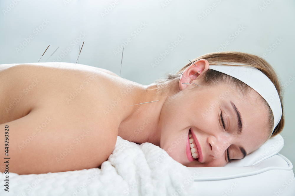 Doctor puts needles into female back on the acupuncture treatment therapy in spa salon. Alternative Medicine concept - obrazy, fototapety, plakaty 