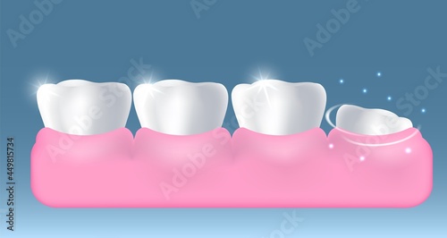 White healthy teeth and growing up new tooth, vector illustration. Dentistry, dental health, oral hygiene, stomatology.