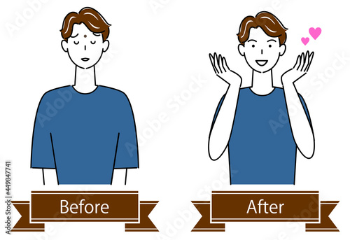 スキンケア 顔のお肌トラブル"ほくろ"のビフォーアフター 可愛い男性のイラスト シンプル ベクター