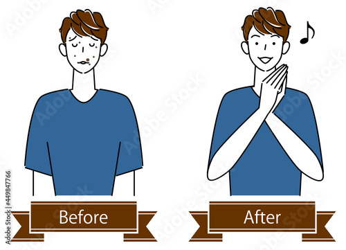 スキンケア 顔のお肌トラブル"ほくろ"のビフォーアフター 可愛い男性のイラスト シンプル ベクター