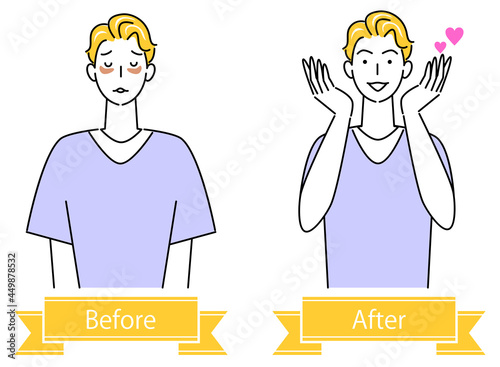 スキンケア 顔のお肌トラブル"シミ・肝斑"のビフォーアフター 可愛い男性のイラスト シンプル ベクター