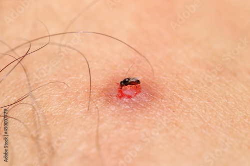 Jackal fly / Freeloader fly (milichiidae) a tiny size fly sucking blood on the human wound