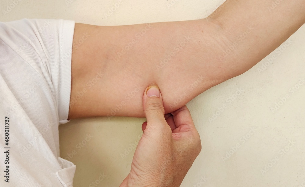 Women's hand pulling underarm of saggy skin. Women's hand pulling underarm of saggy skin.