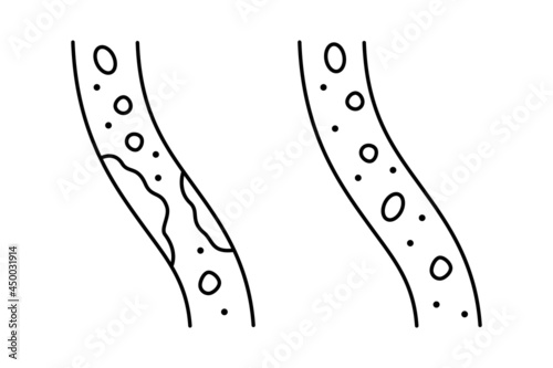 black blood vessels with cholesterol and healthy sign