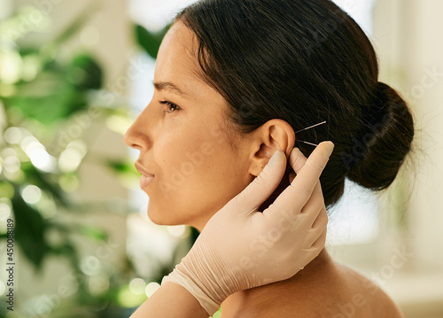 Obraz na plátně Woman having ear acupressure or ear acupuncture for her diseases treatment, side view