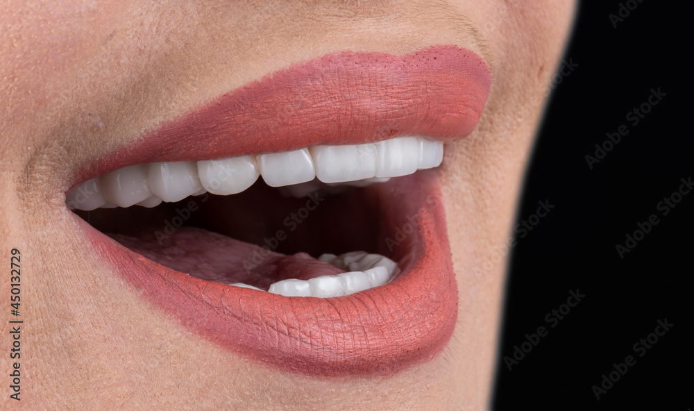 Obraz premium press ceramic crowns and veneers