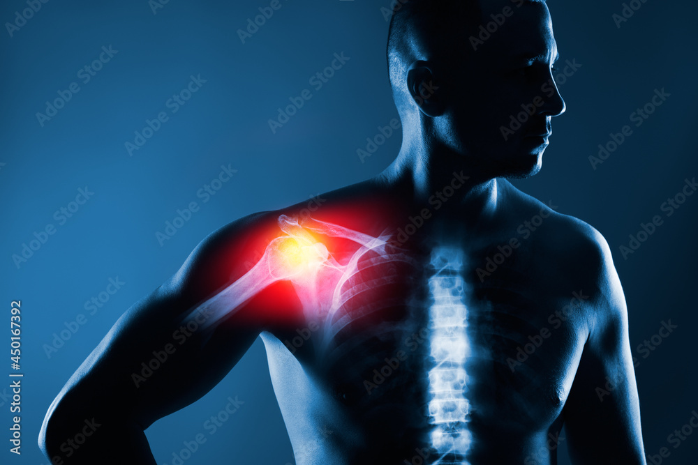 Obraz premium Human shoulder joint in x-ray on blue background