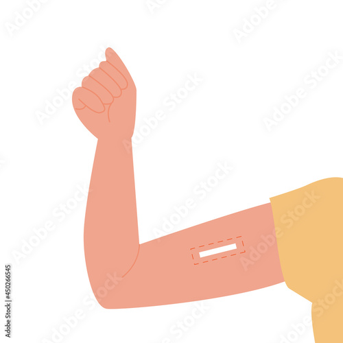 Contraception method. Vector flat female arm with inserted contraceptive implant. Birth control for women and pregnancy prevention. Illustration. photo