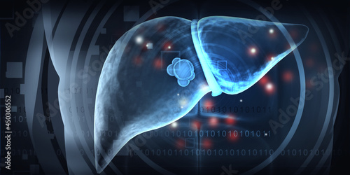 Photos Cancer tumor in liver. 3d illustration