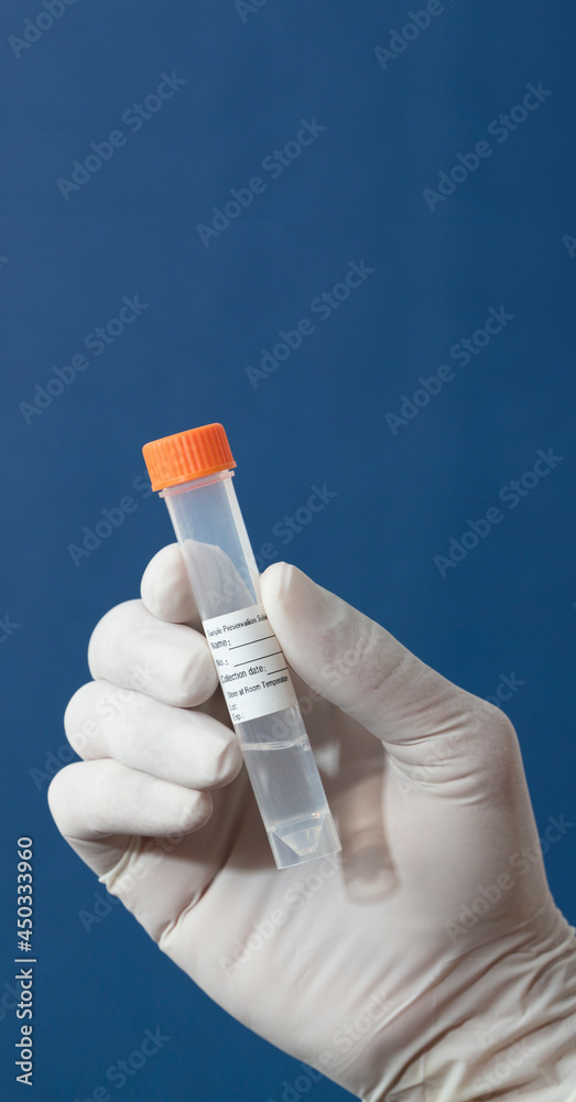 transport vial for laboratory, with red cap and sticker personal data in the hands of doctor, with blue background transport vial for laboratory, with red cap and sticker personal data in the hands of doctor, with blue background