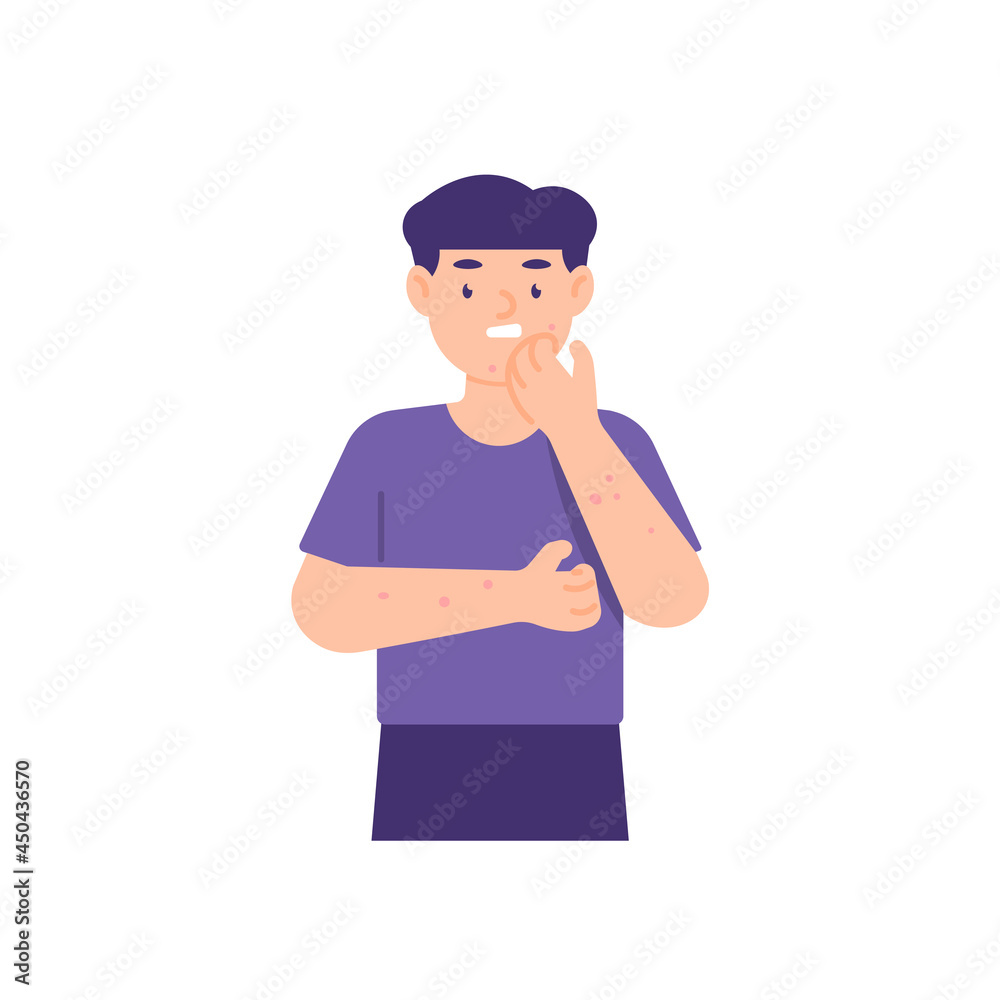 illustration of a boy scratching his body because he feels itchy. due to infrequent bathing. bumpy skin. skin disease. flat cartoon style. vector design elements