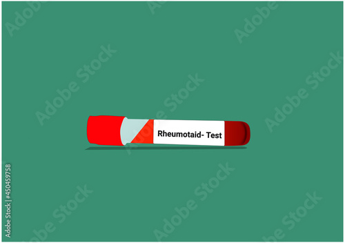 Blood samples for Rheumotaid test in the test tube vector with a dark background. 