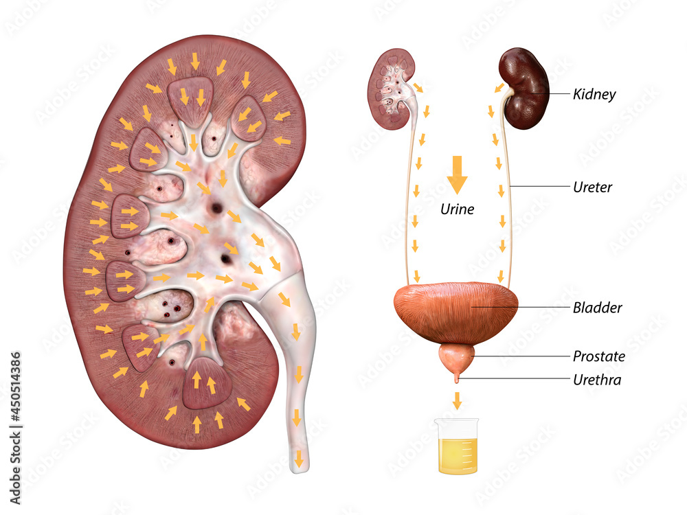 Scientific medical illustration of incision through the kidney