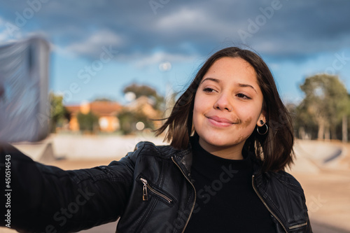Portrait of a teenage girl with a birthmark on her smiling face in an urban park.