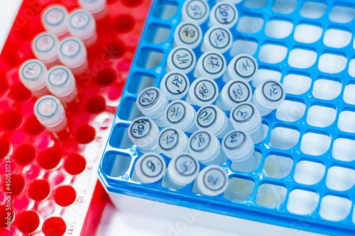 Rack of test tubes in medical laboratory