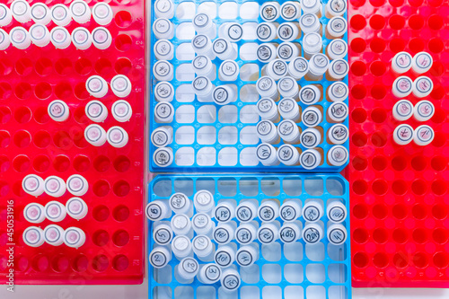 Top-down view of trays with different test tubes in medical laboratory