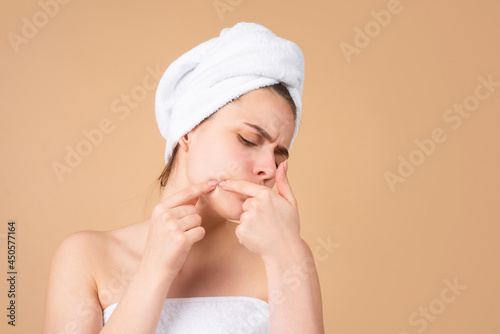 Woman squeezing pimples on her face. Acne blemish spots skin on young girl. Spot scar acne, freckles, and melasma pigmentation skin facial treatment, problem skin concept.