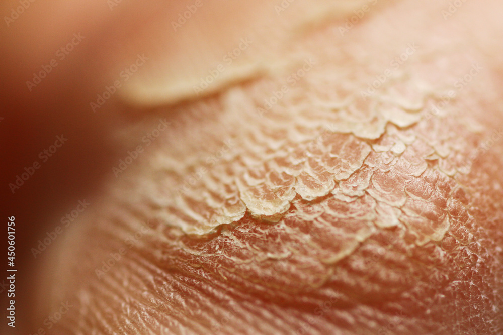 Fototapeta premium Macro of dry foot skin