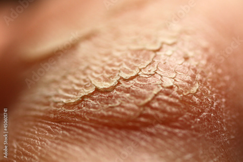 Macro of dry foot skin