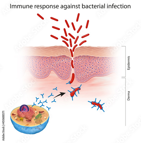 Immune response against bacterial infection photo