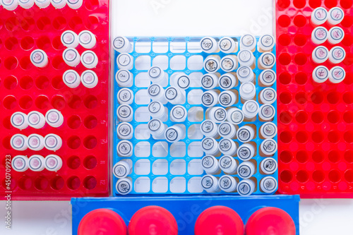 Top-down view of test tubes boxes with sample liquied in the medical laboratory