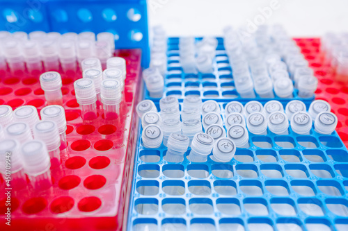 Close-up shot of tray with test tubes in medical laboratory