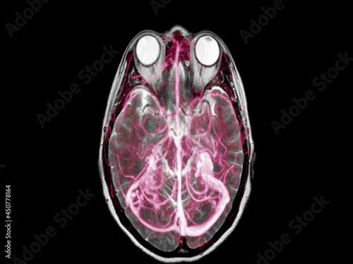 Magnetic resonance imaging mri of the human brain. Closeup. Medical technology concept.