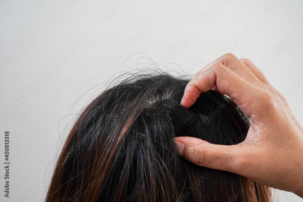 Fototapeta premium Close up of people hand scratching head, concept of fungus on the scalp. 
