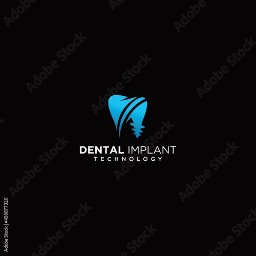 Dental implant clinic technology logo design vector dental implant logo modern dental logo icon