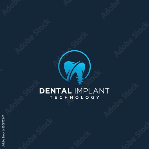 Dental implant clinic technology logo design vector dental implant logo modern dental logo icon