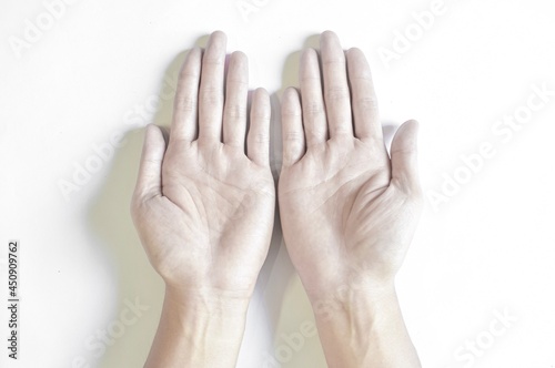 Pale palmar surface of hands. Anaemic hands of Asian man. photo